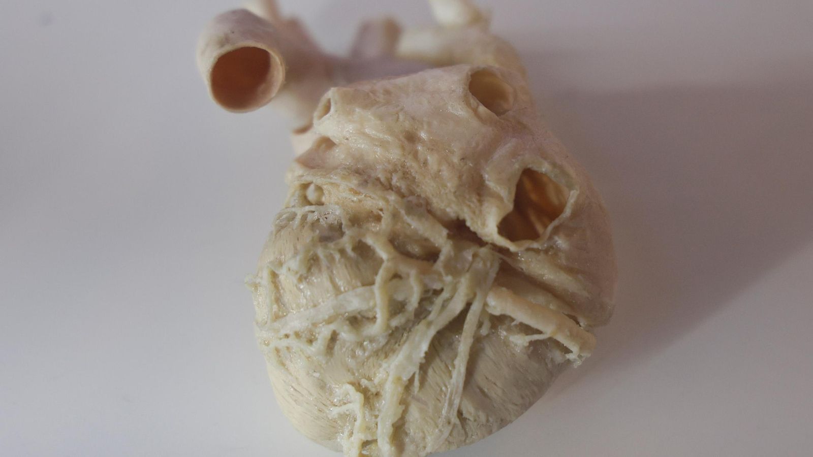 Un corazón plastinado. Un corazón plastinado.