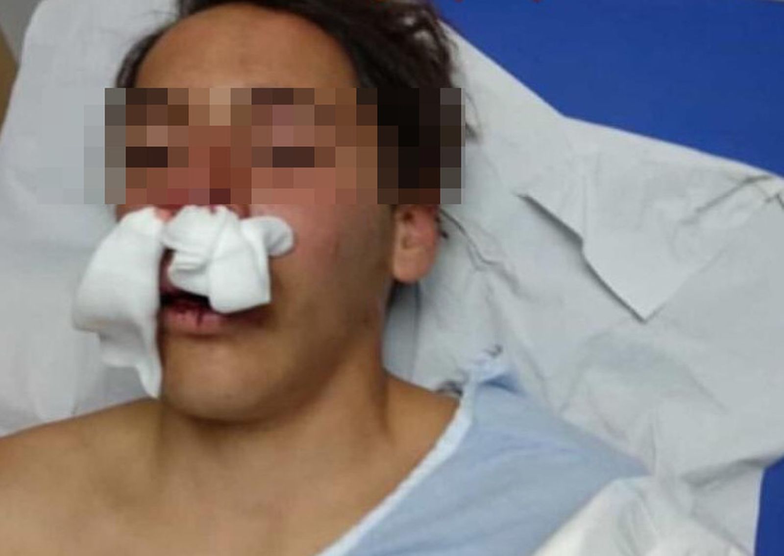 Estado del menor tras la paliza de unos policías en Melilla