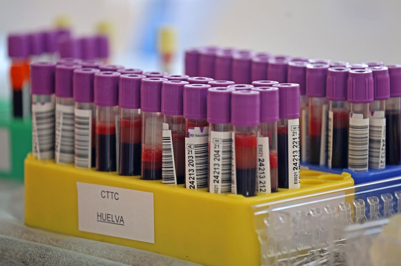 Imágenes de la macrocolecta de sangre y plasma en la Casa Colón