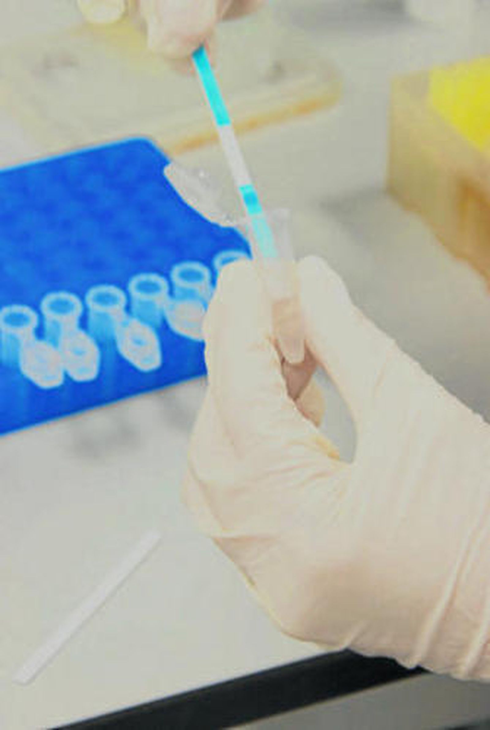 En el estudio ha colaborado el Instituto López Neyra de Granada.