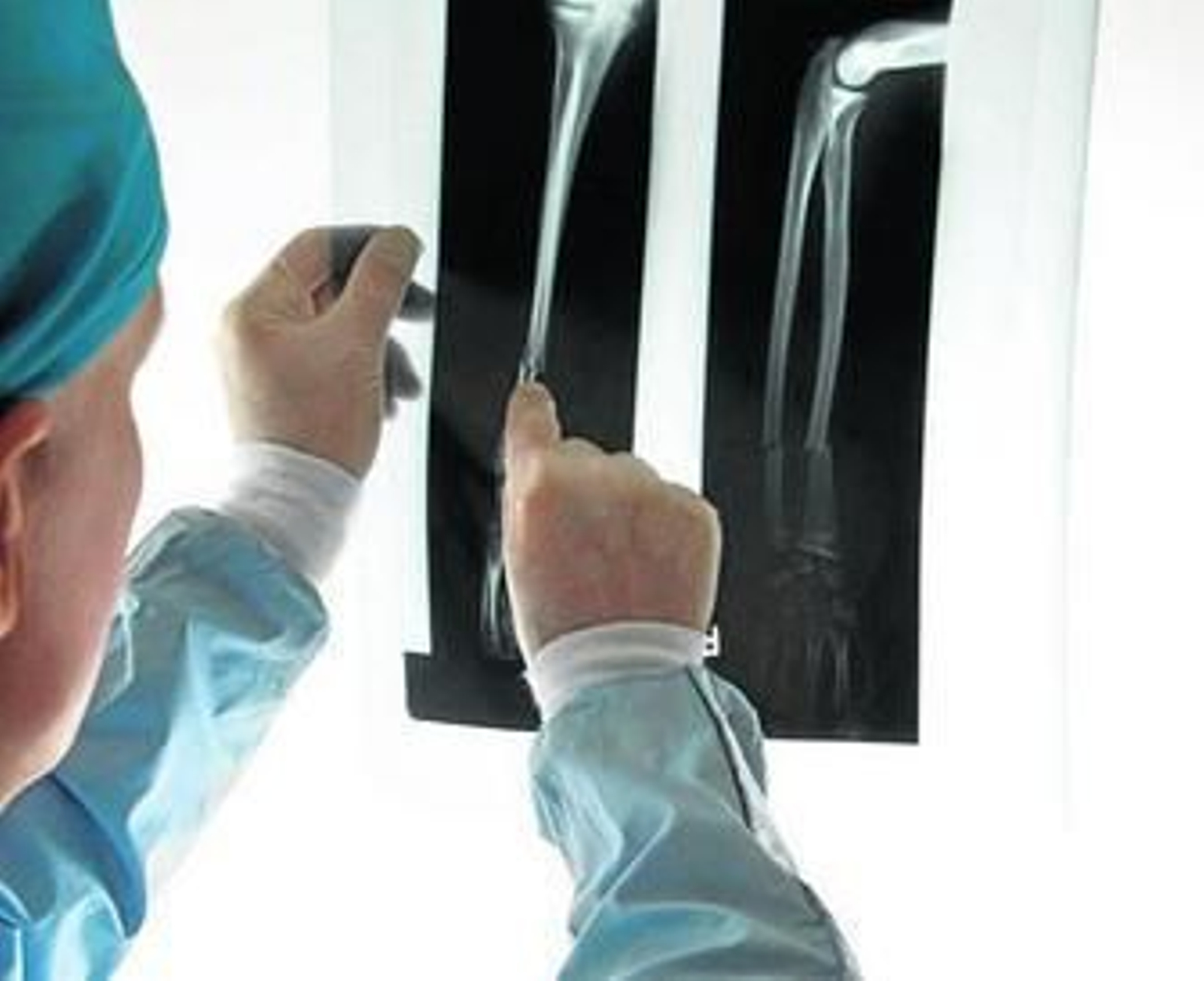 Desde la traumatología y la fisioterapia se trata de introducir la cultura del cuidado articular.