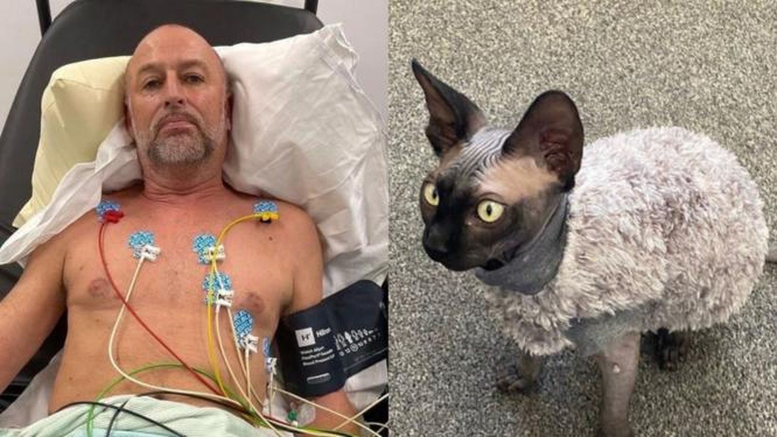 Un hombre estuvo al borde de la muerte tras tropezar con su gato y ahora usa silla de ruedas