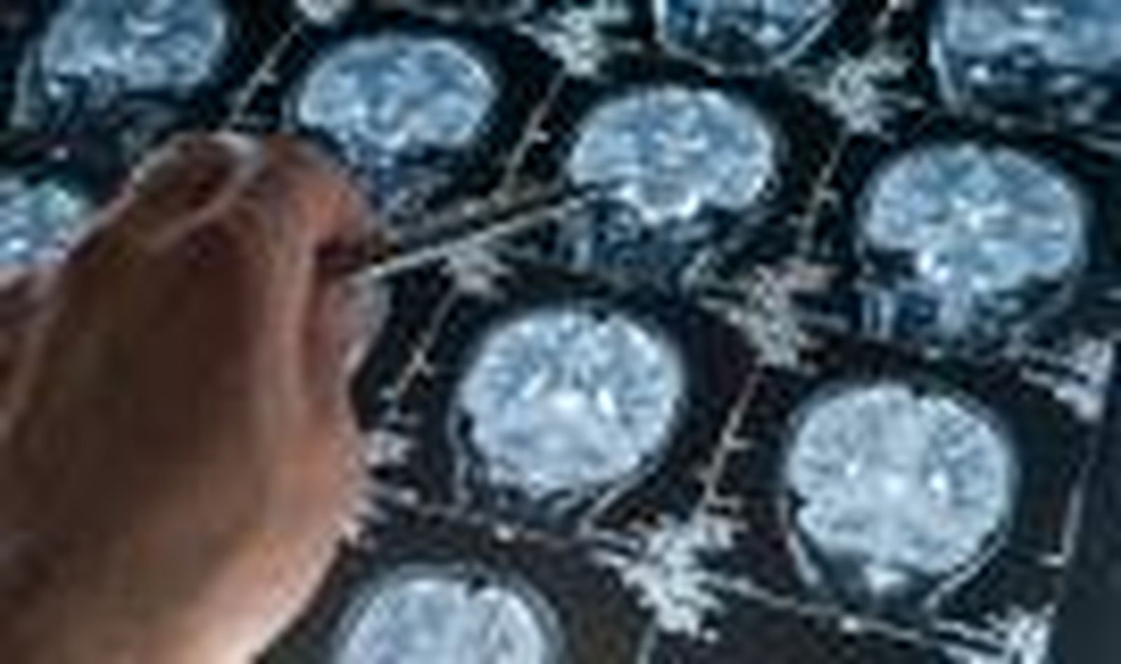 La respuesta cerebral a los alimentos varía según la complexión corporal