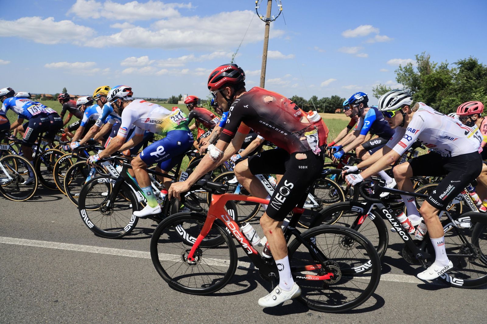 Las imágenes del Tour de Francia | Segunda etapa