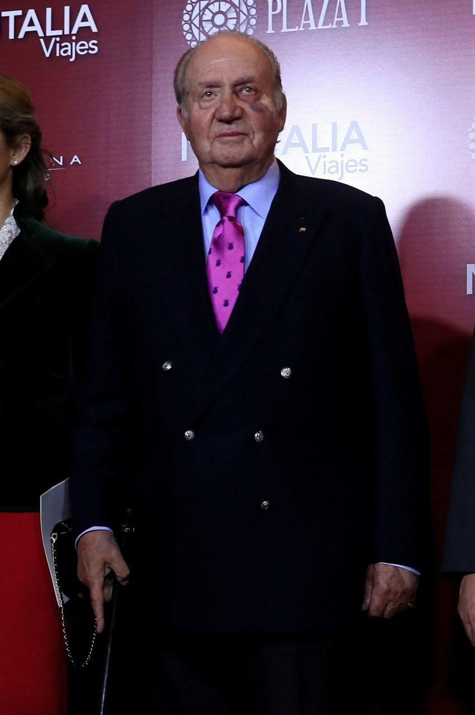 Don Juan Carlos, en Las Ventas hace unos días con un ojo morado.