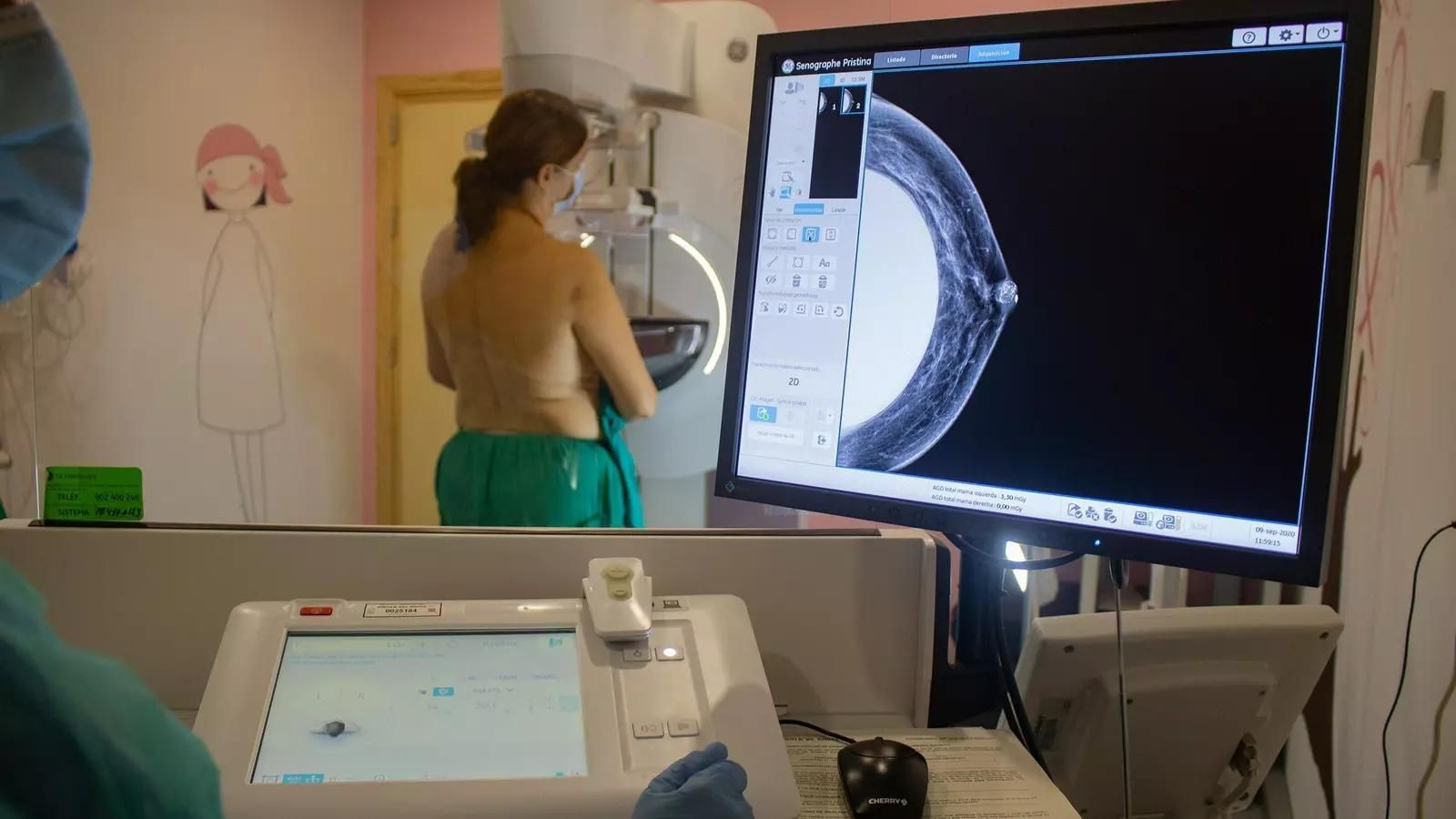 Una paciente durante la realización de una mamografía, prueba clave dentro del programa de cribado para la detección precoz del cáncer de mama