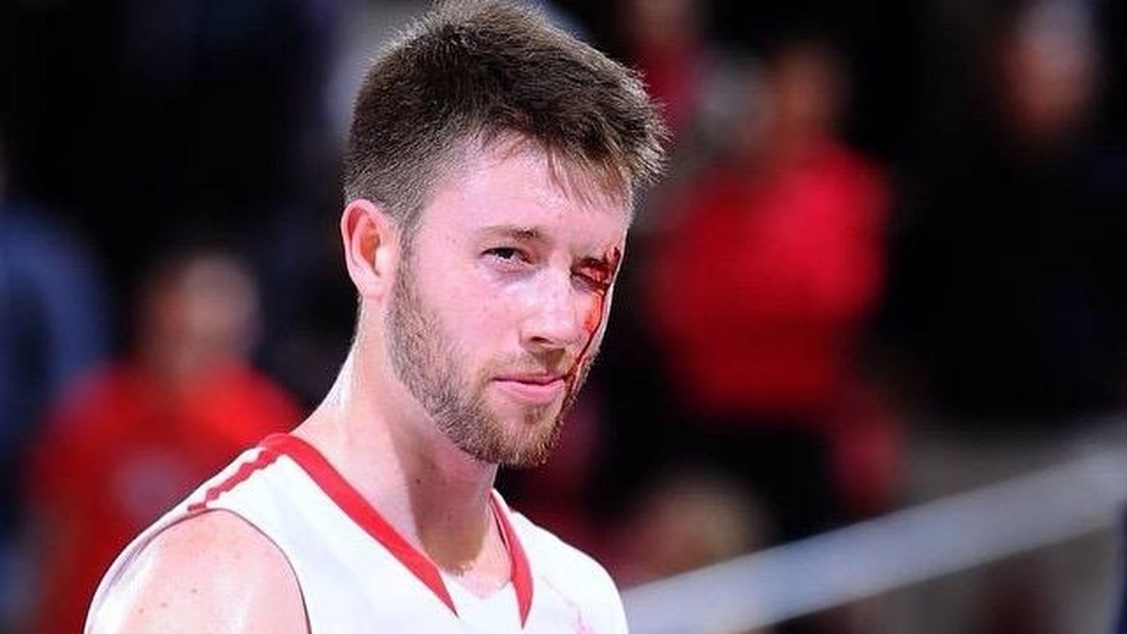 Kalinoski, con una herida en Davidson.