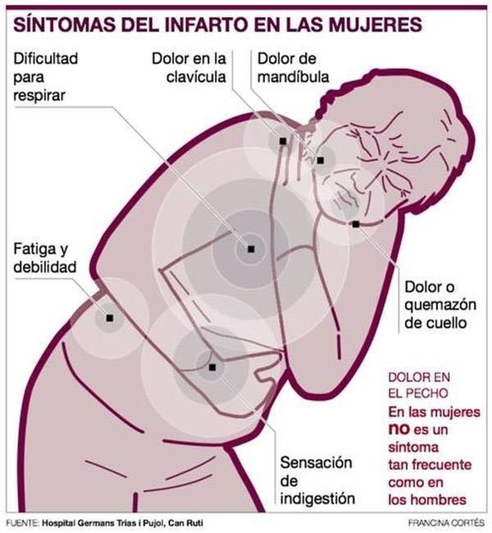 Los peligros del infarto femenino