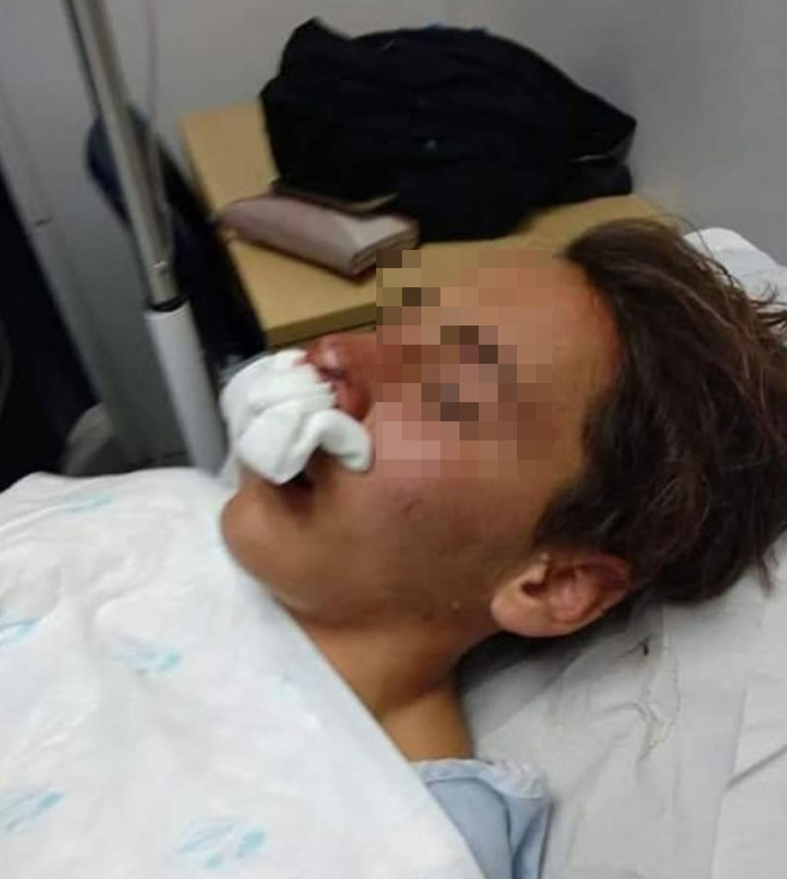 Estado del menor tras la paliza de unos policías en Melilla