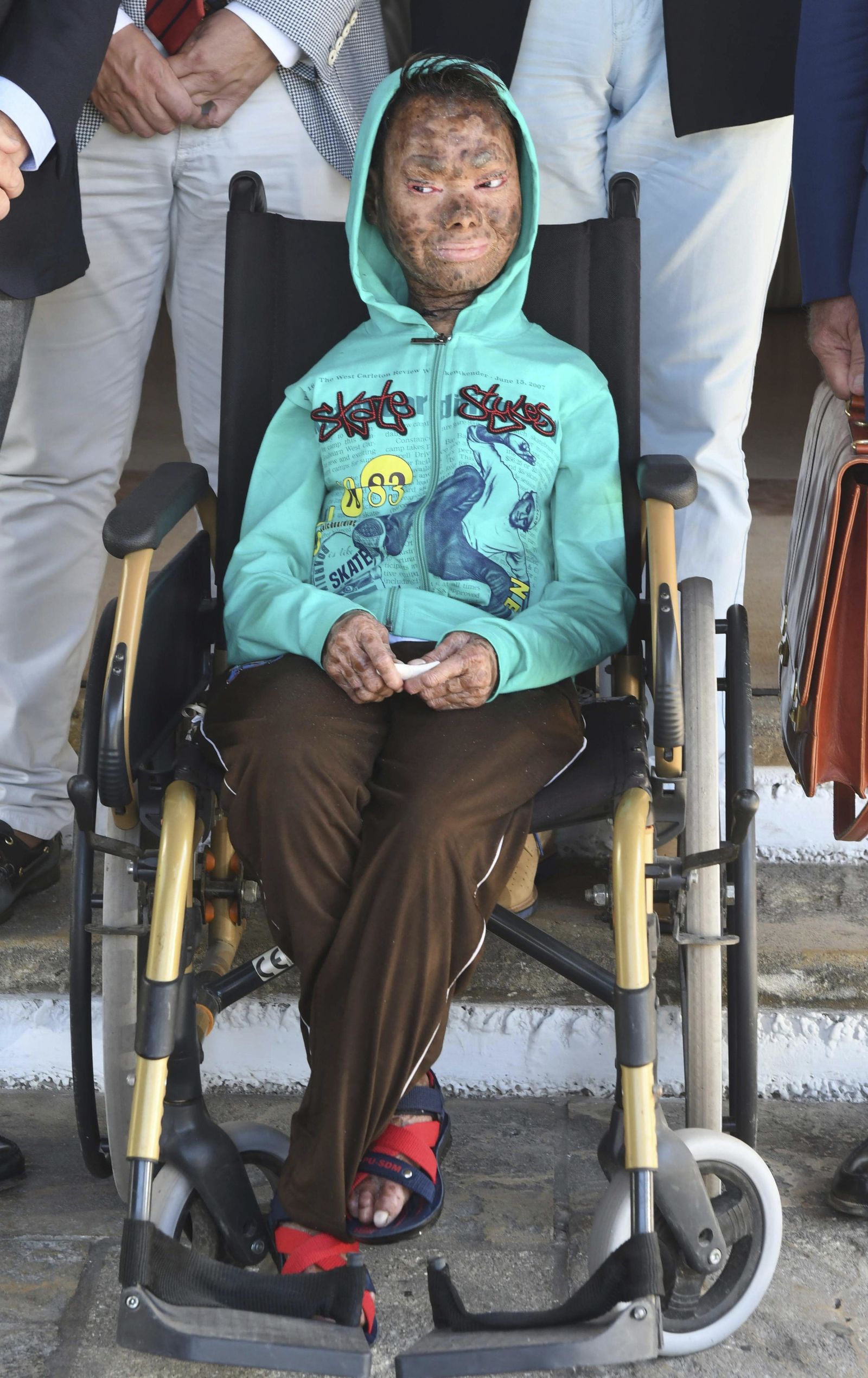 La paciente, ayer a su llegada.