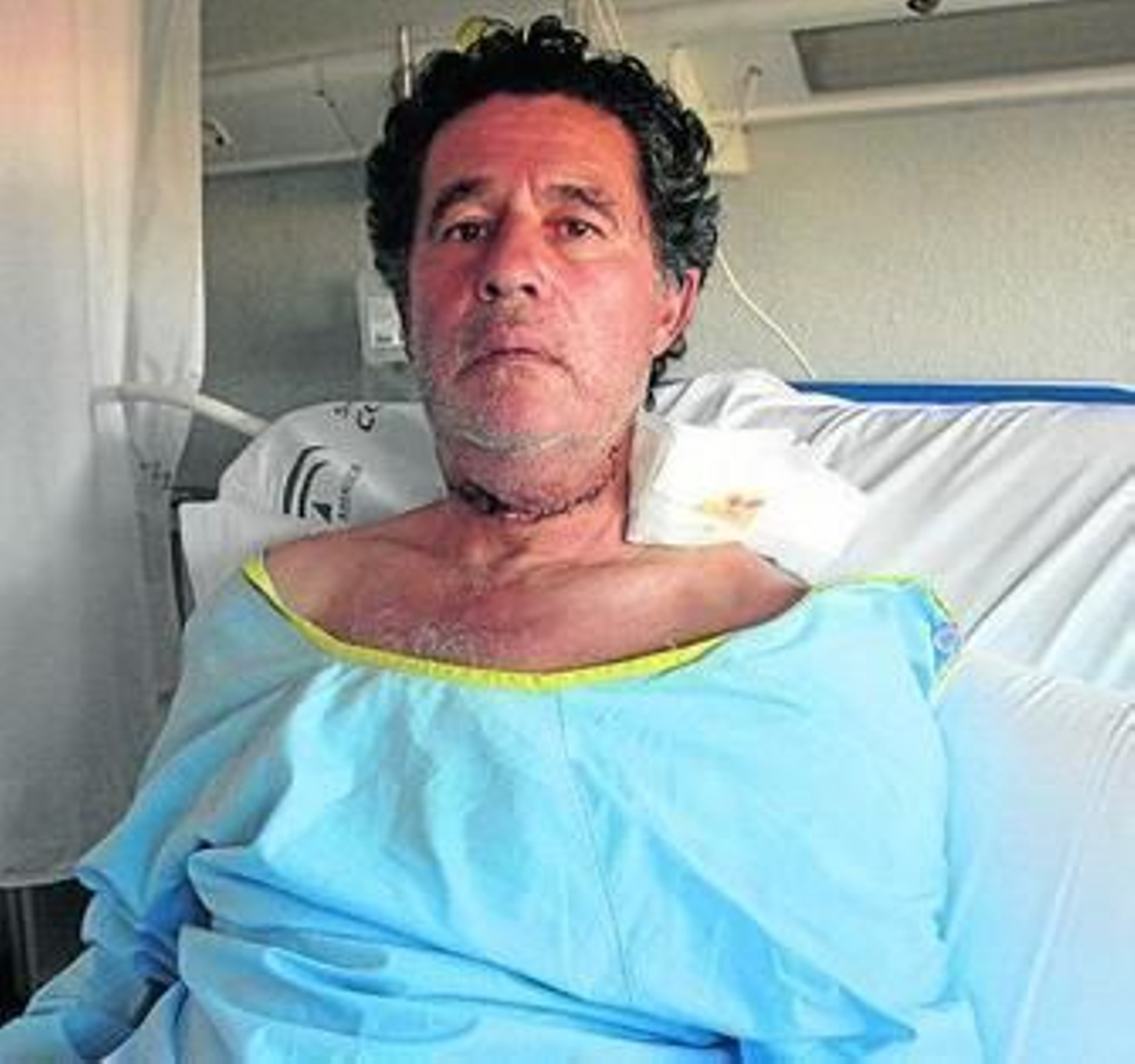 Campuzano, tras ser operado ayer, con las secuelas de la cornada en el cuello.