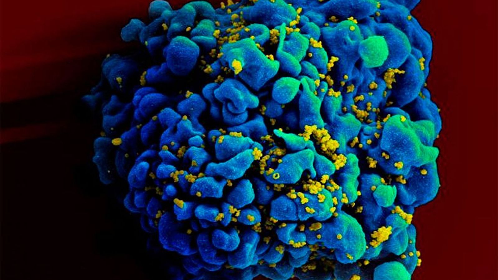 Chapare, así es el virus mortal reaparecido en Bolivia