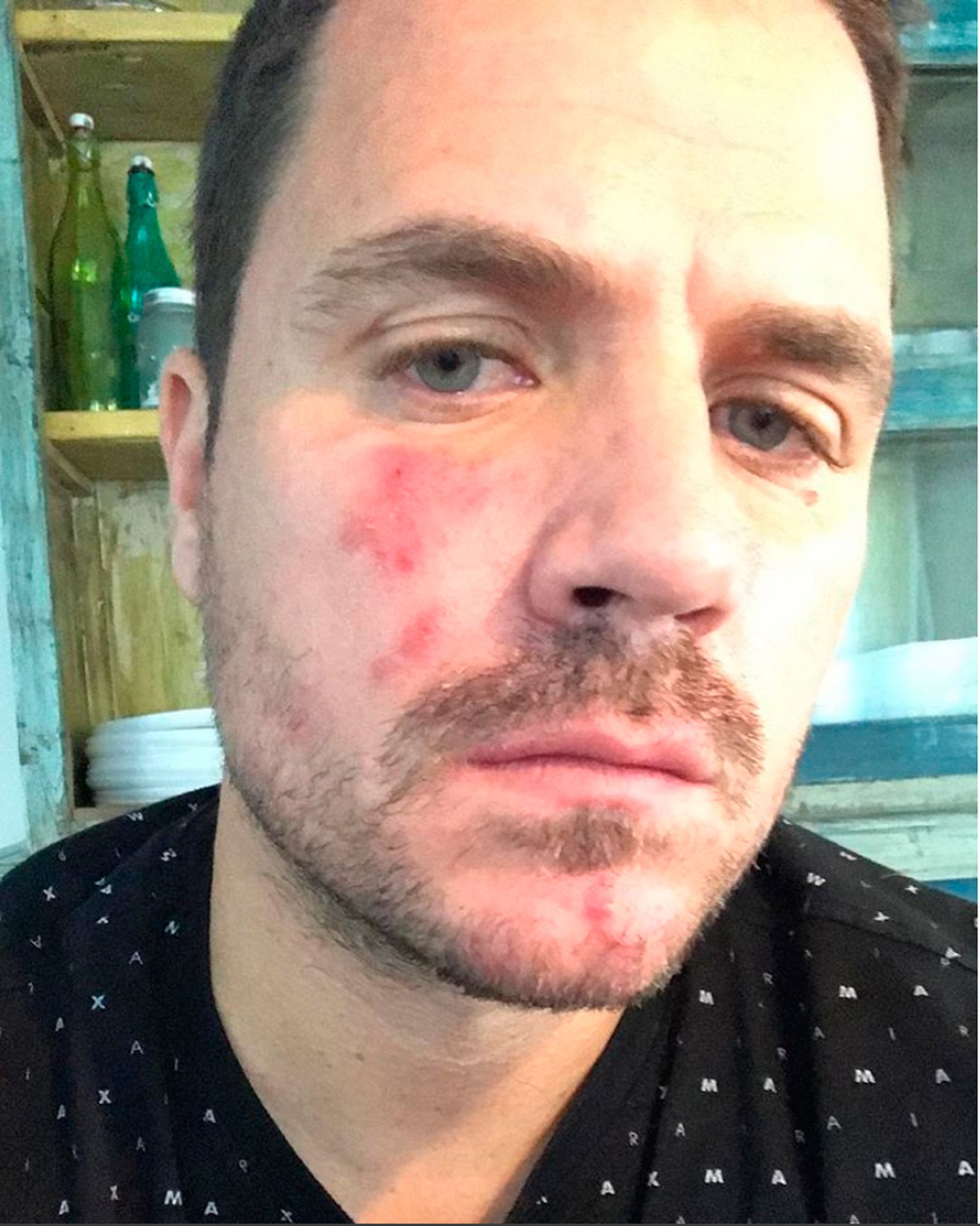 Dani Martín, en la imagen que él mismo ha compartido en redes.