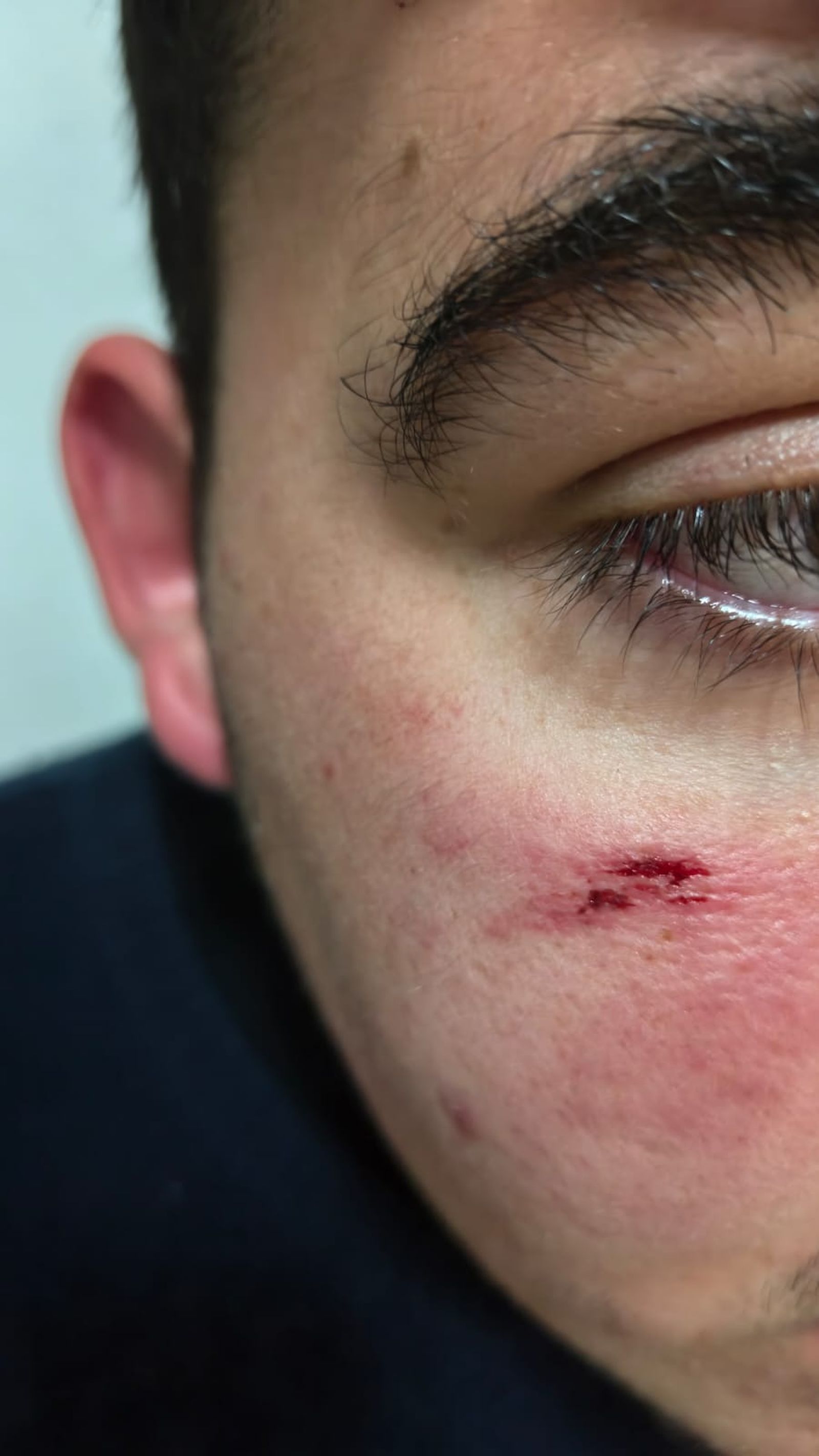 El agredido recibió golpes y patadas