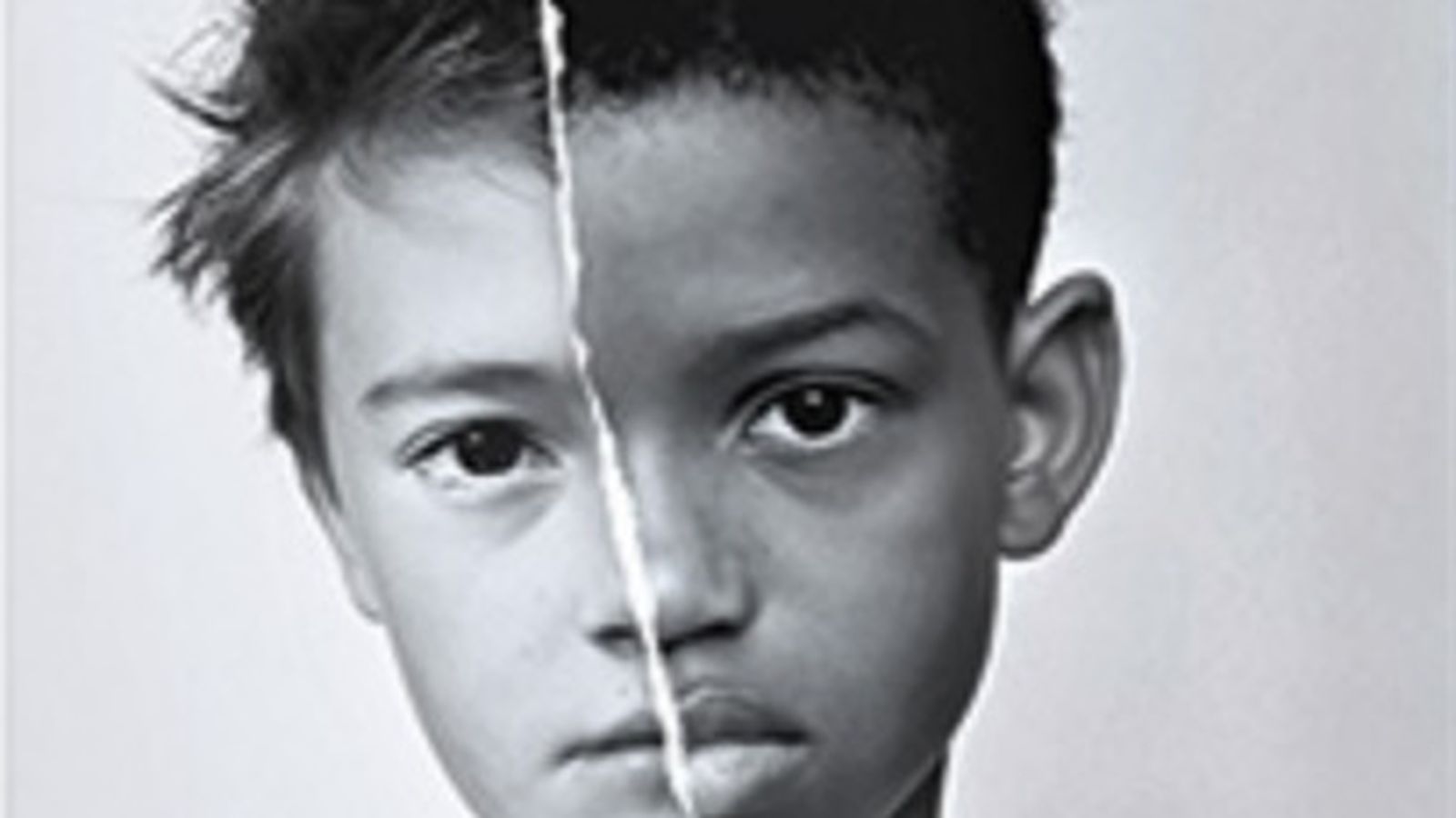 Portada del corto 'Skin'