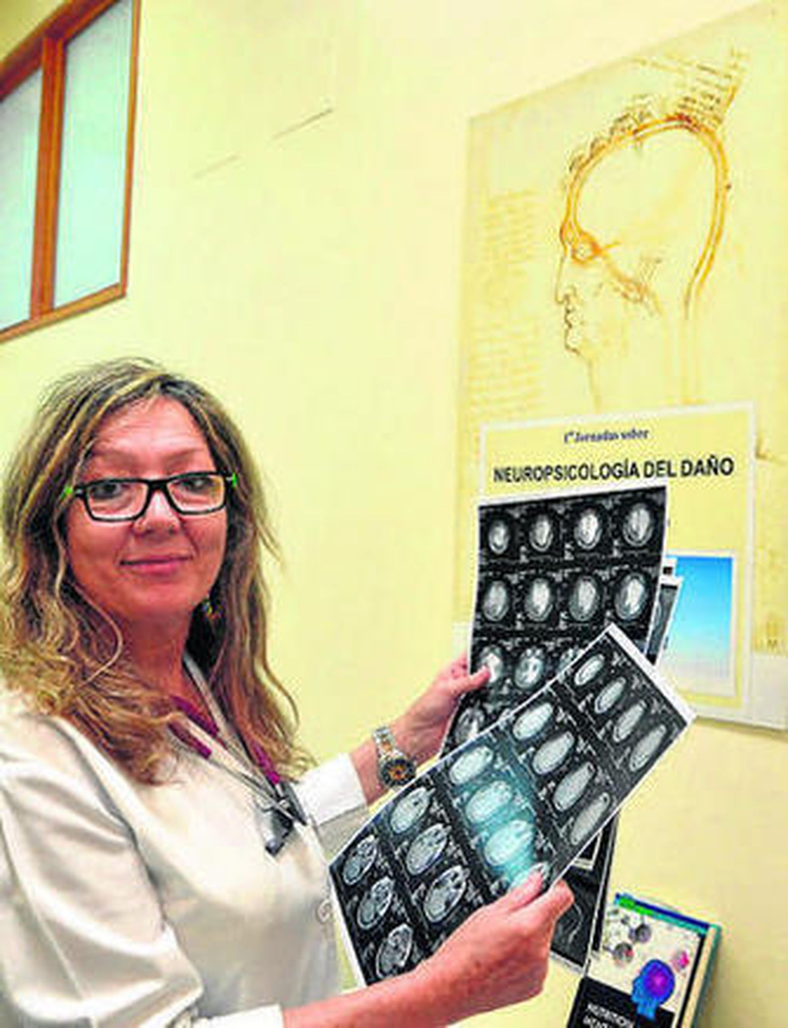 El calor, un riesgo para el daño cerebral