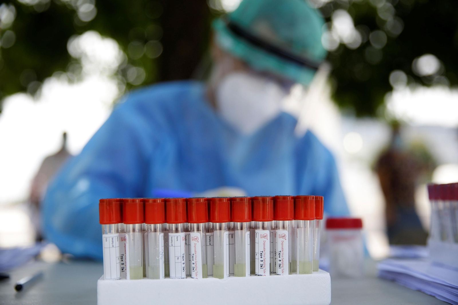 Un sanitario y varias muestras de pruebas.