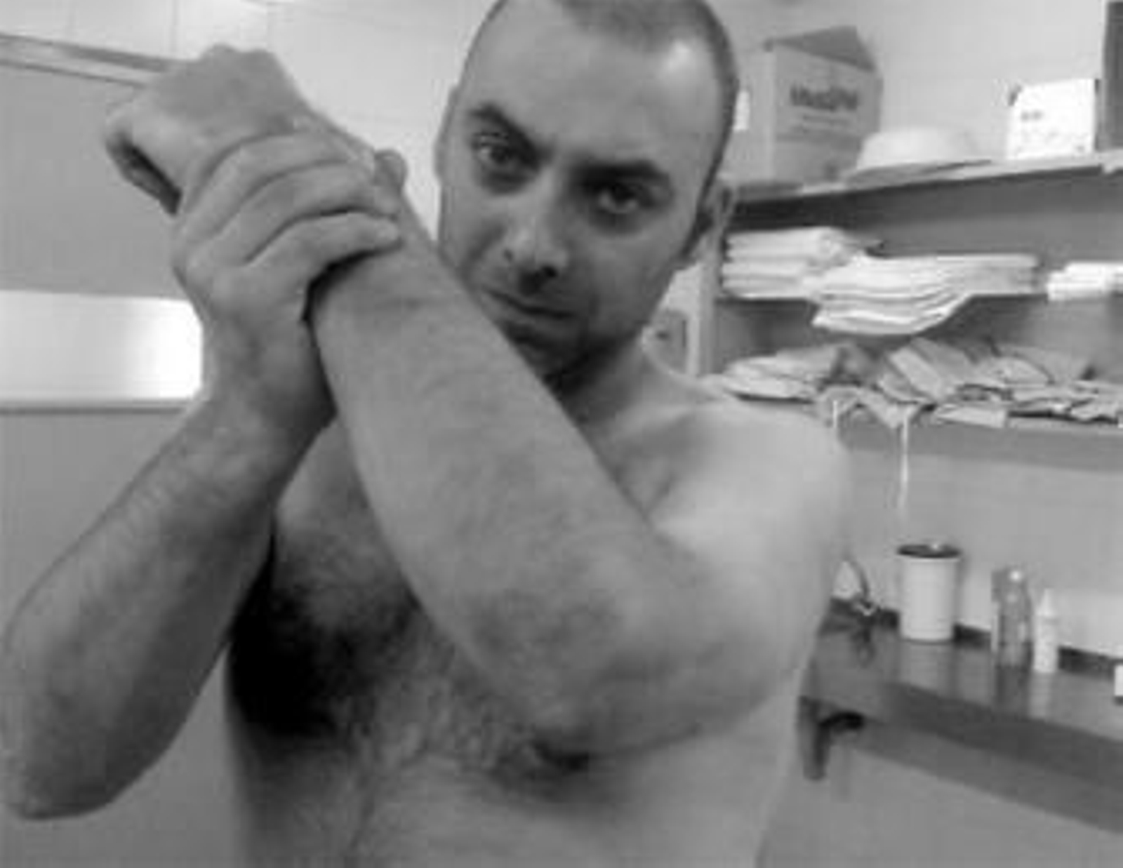 Mario Gómez muestra uno de los hematomas en un brazo.