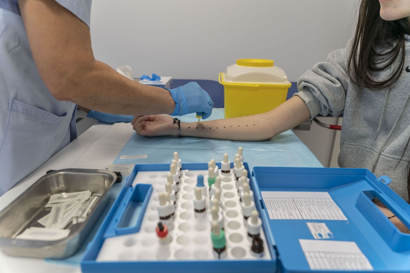 Personal sanitario realiza un test de alergías a una paciente.