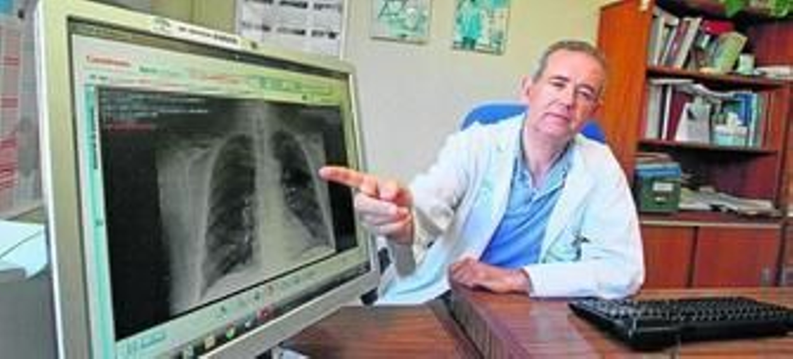 El doctor Francisco Ortega, jefe clínico en la Unidad Médico Quirúrgica de Enfermedades Respiratorias del Hospital Virgen del Rocío, muestra la radiografía de pulmones afectados por el tabaco.