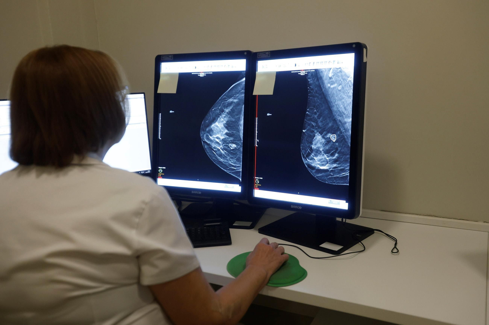 Una doctora consulta una mamografía en Córdoba.