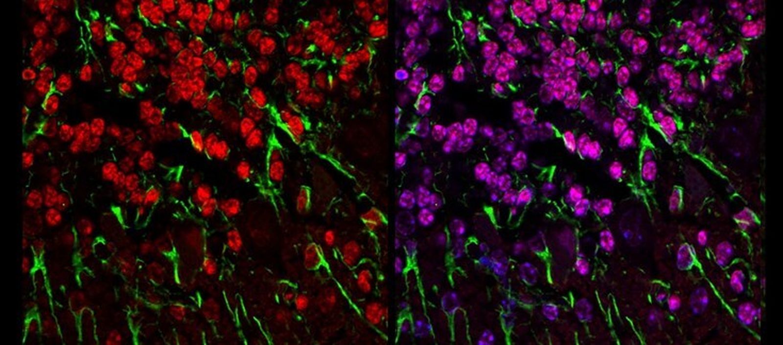 Corte histológico de cerebelo de ratón modelo de enfermedad mitocondrial con neuronas granulares marcadas en rojo y prolongaciones gliales en verde.