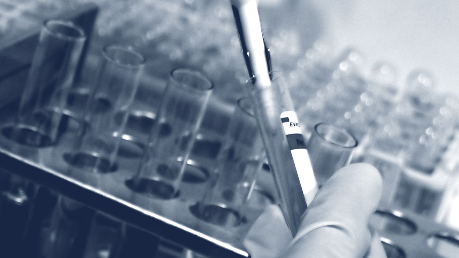 Vacunas contra el coronavirus.