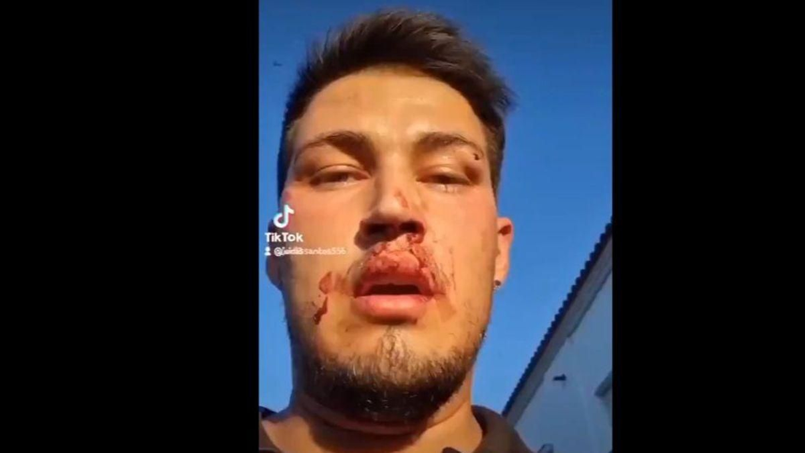 Imagen que ha colgado en sus redes sociales el agredido.