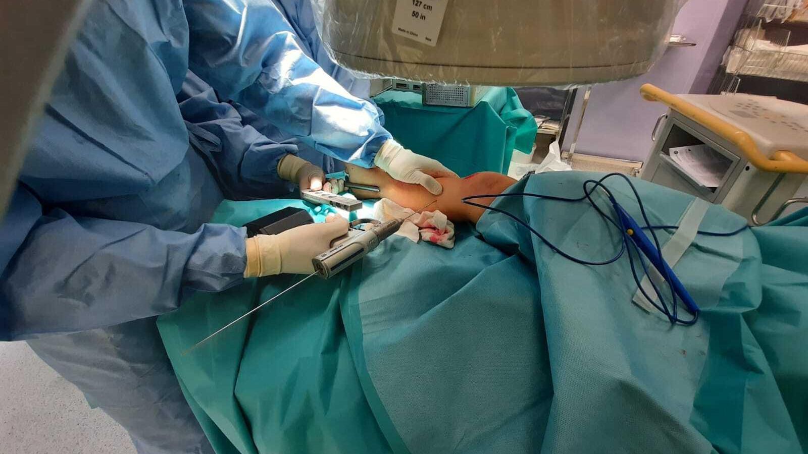 Momento de la intervención.