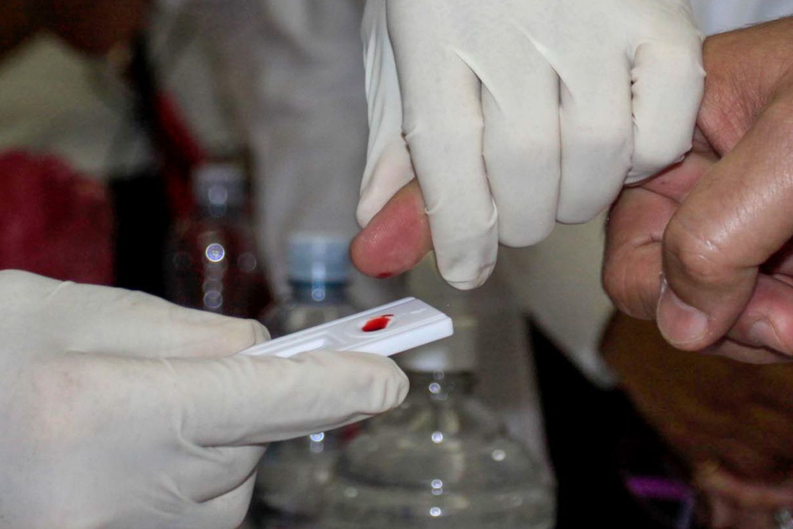 Test de detección del VIH