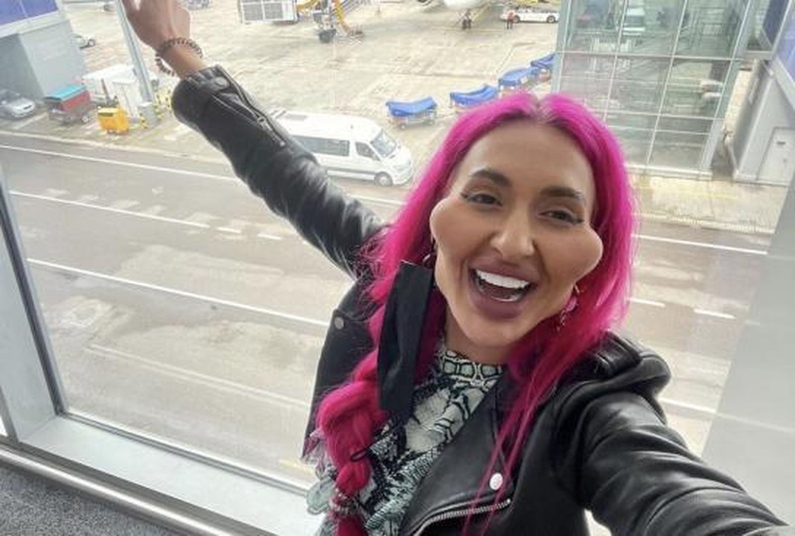 Anastasia busca convertirse en la mujer que ostente el título oficial a los pómulos más grandes del mundo