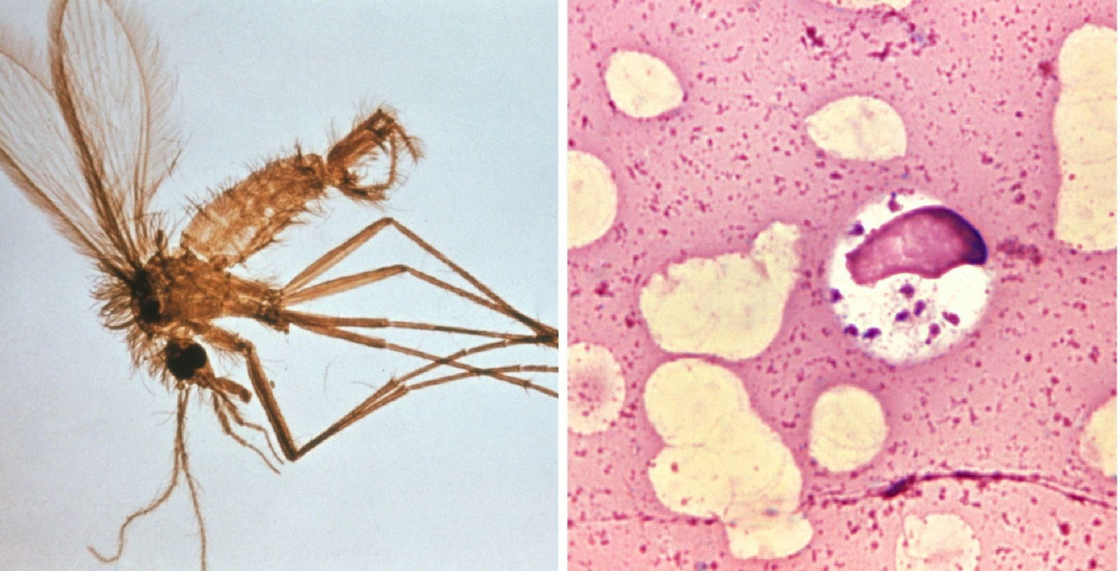 A la izquierda, flebótomo -transmisor de la enfermedad-, y a la derecha, 'Leishmania' visceral en células de médula ósea