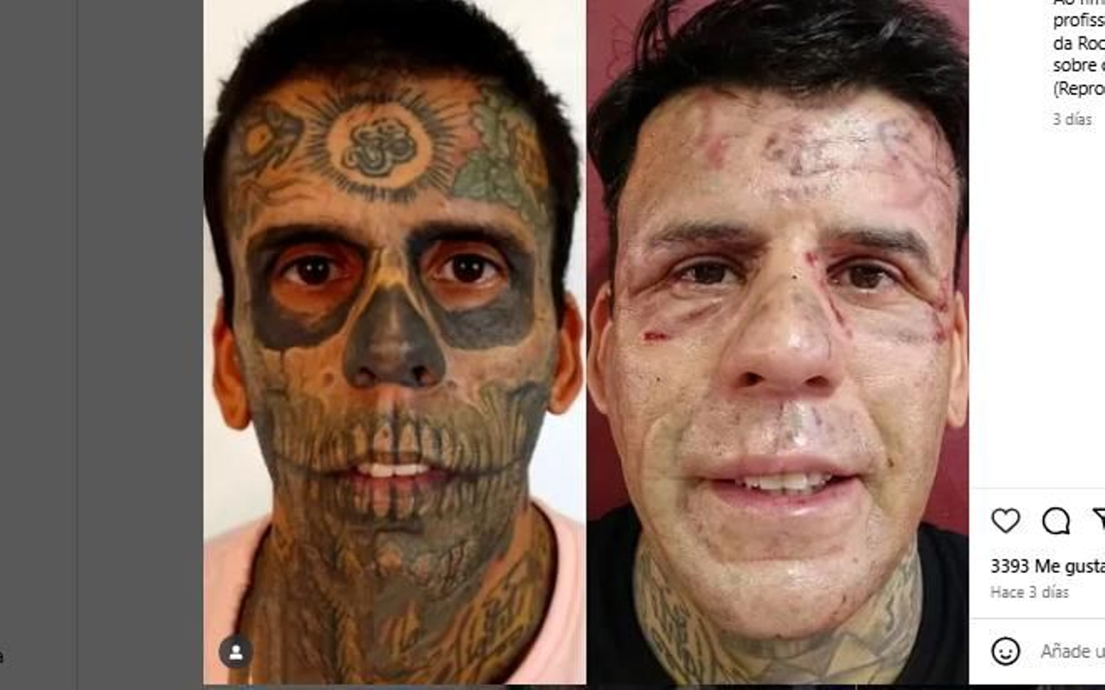 El antes y el después