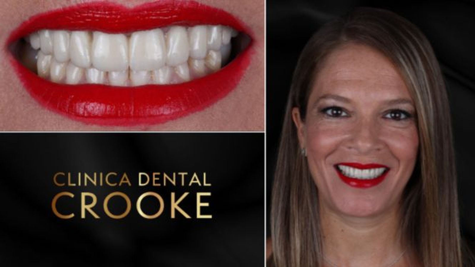 Una nueva sonrisa, una nueva vida