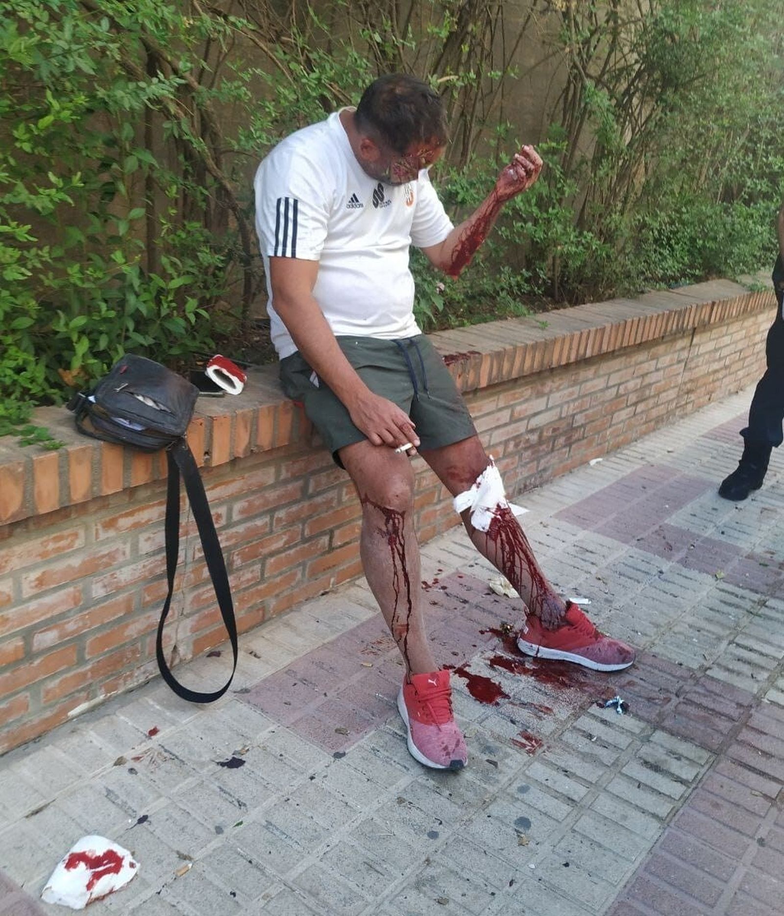 Un herido en accidente de tráfico es atendido con papel higiénico por agentes de la Policía Local.