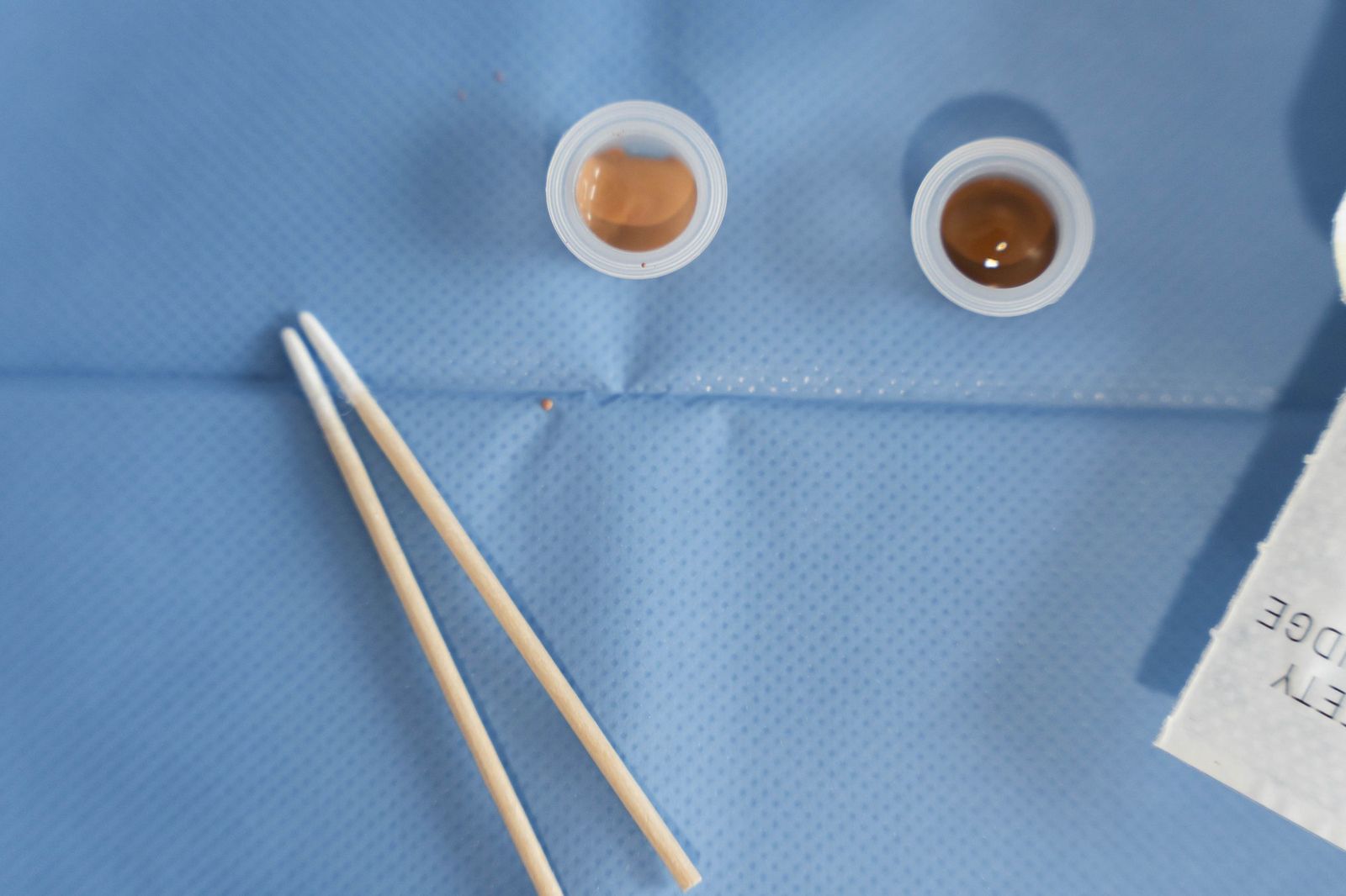 Un tratamiento de micropigmentación por mastectomía en un hombre, en imágenes