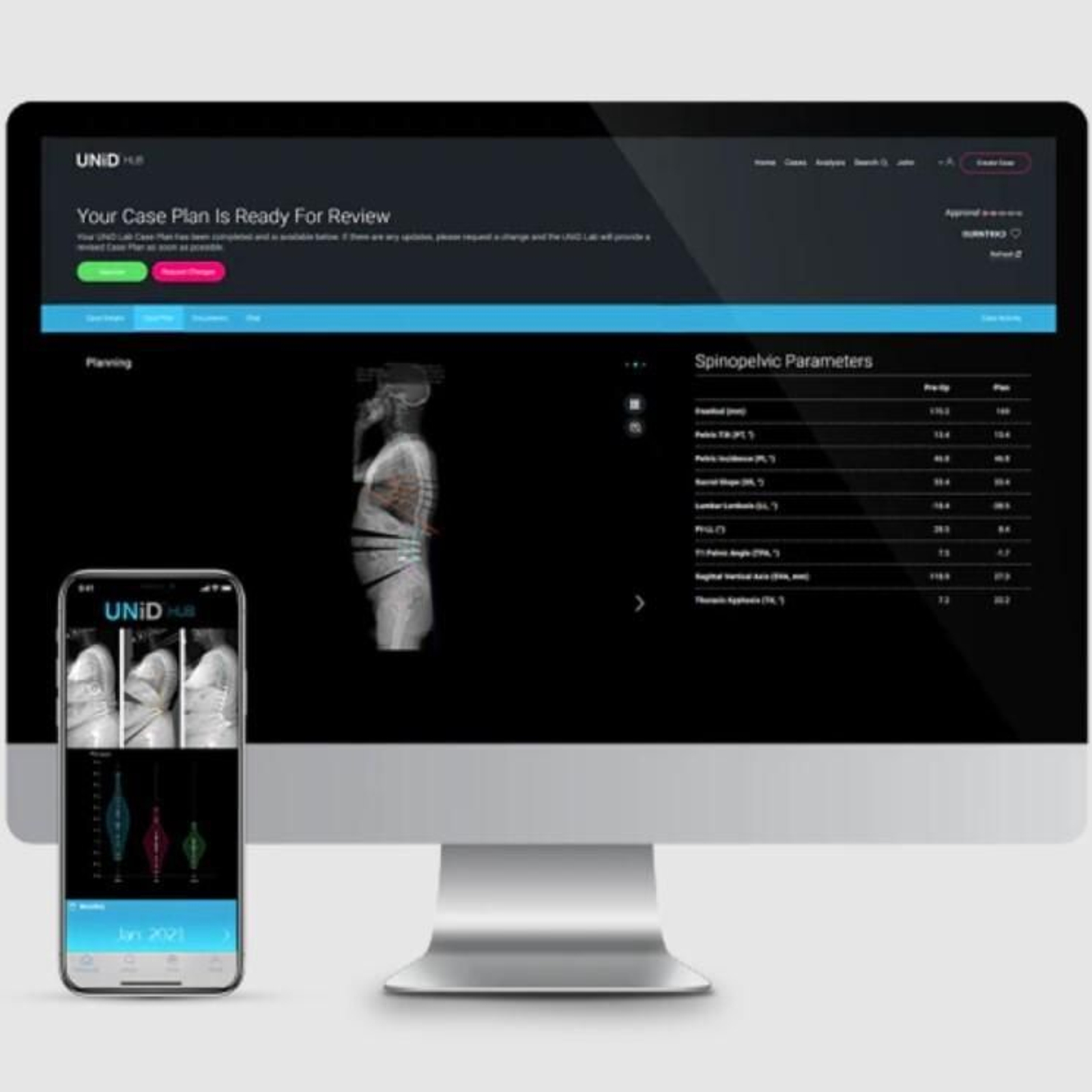 El sistema de inteligencia artificial.