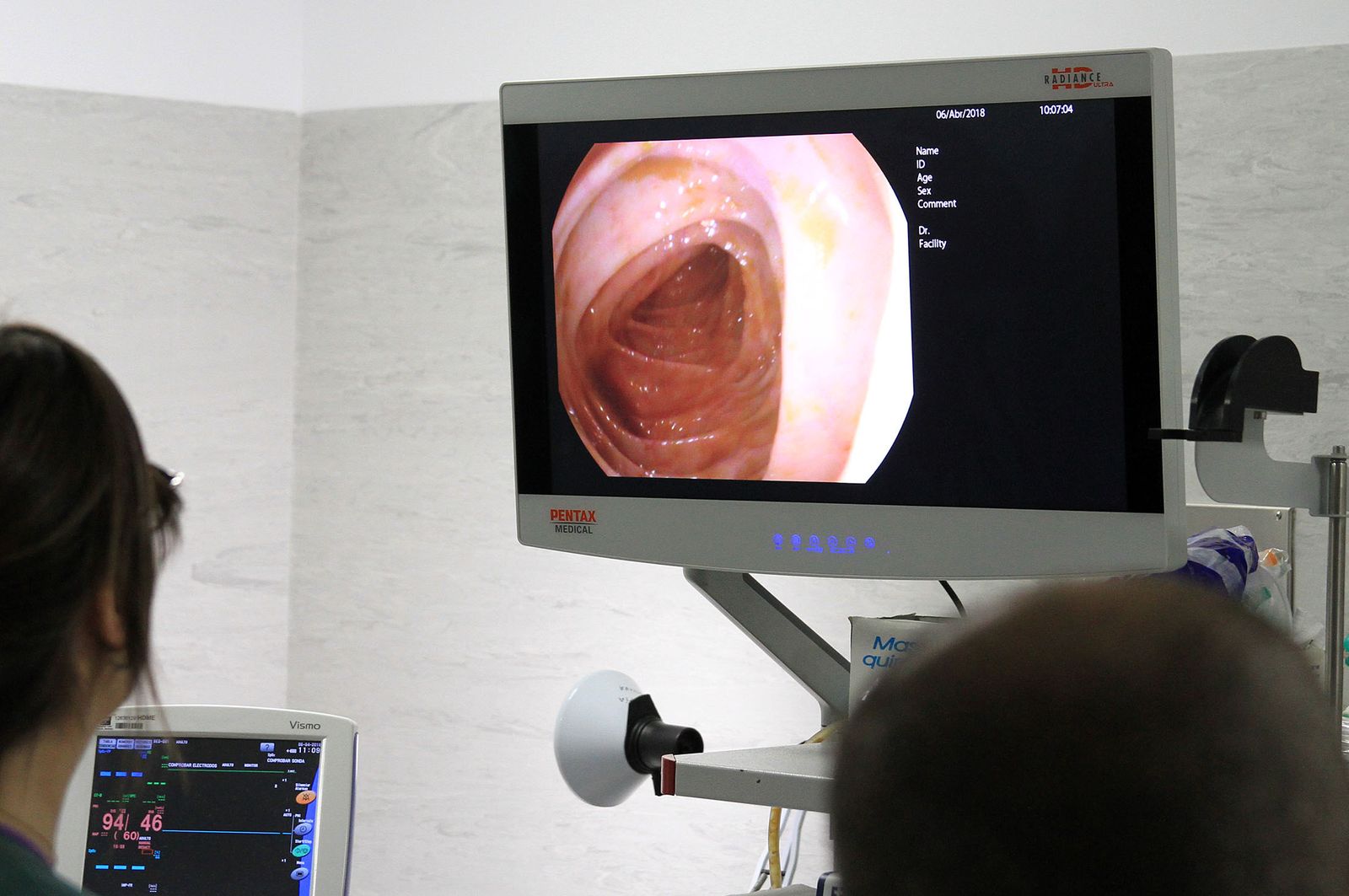 Imagen del resultado de una endoscopia.