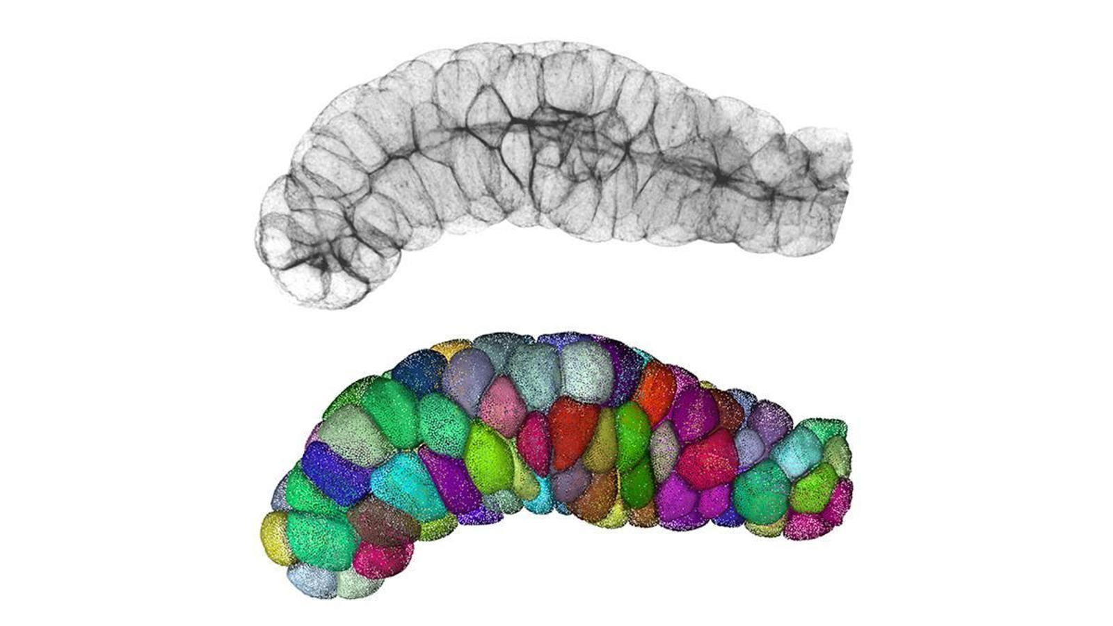 Tejido glandular dónde el conjunto de células epiteliales forman un tubo. Arriba se muestra la imagen proveniente del microscopio. Abajo se muestra la imagen procesada por ordenador para poder cuantificar las propiedades del tejido.