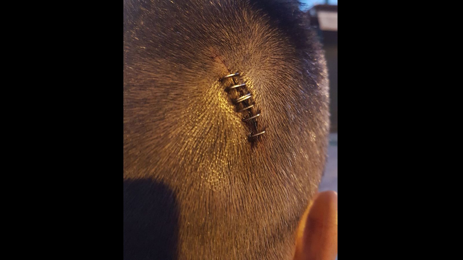 La herida cerrada con grapas del policía