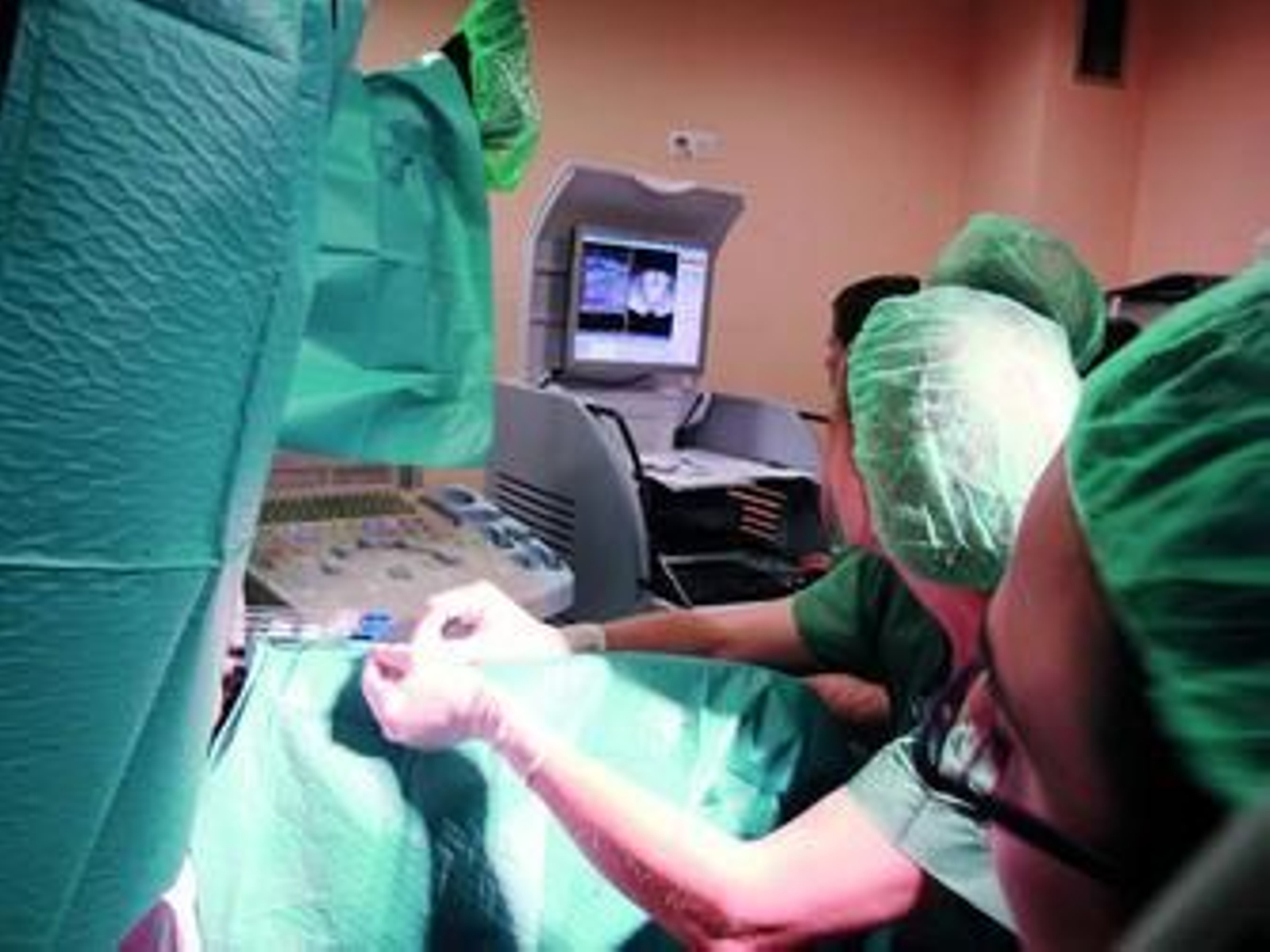 Aplicación de la braquiterapia de alta tasa.