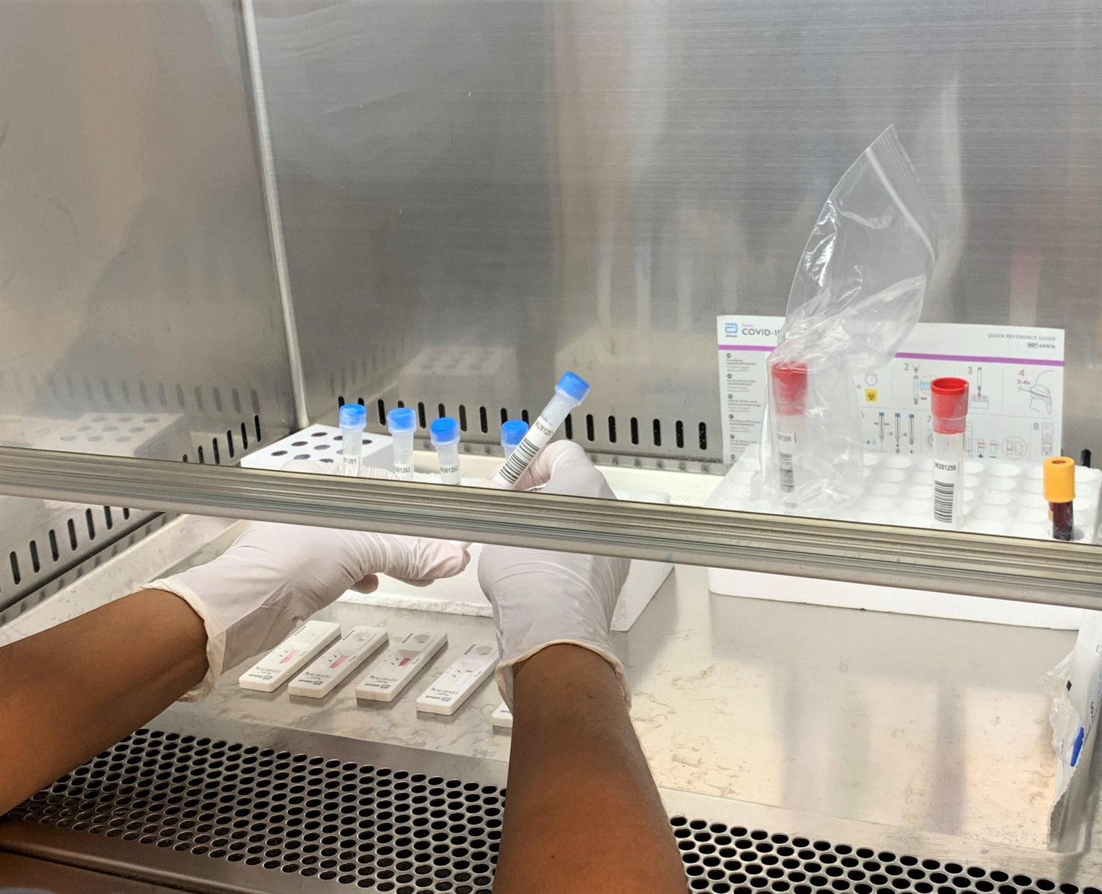 Manipulación de las muestras en un laboratorio de hospitales Quirónsalud.