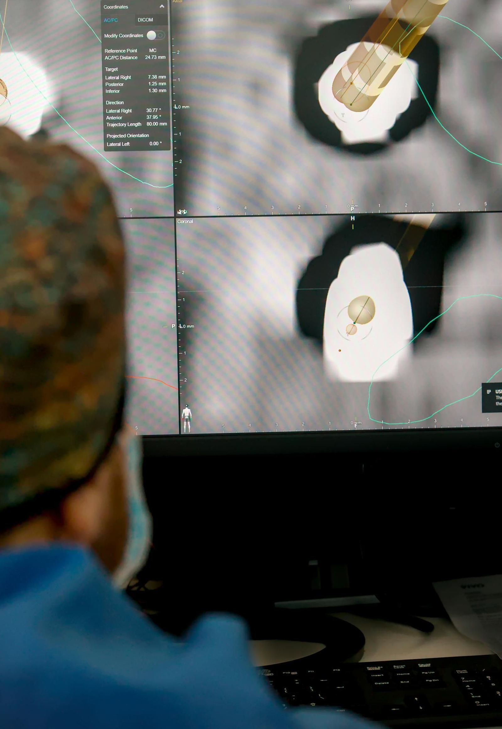 Un sanitario comprueba en pantalla  la correcta colocación de los electrodos tras la intervención.