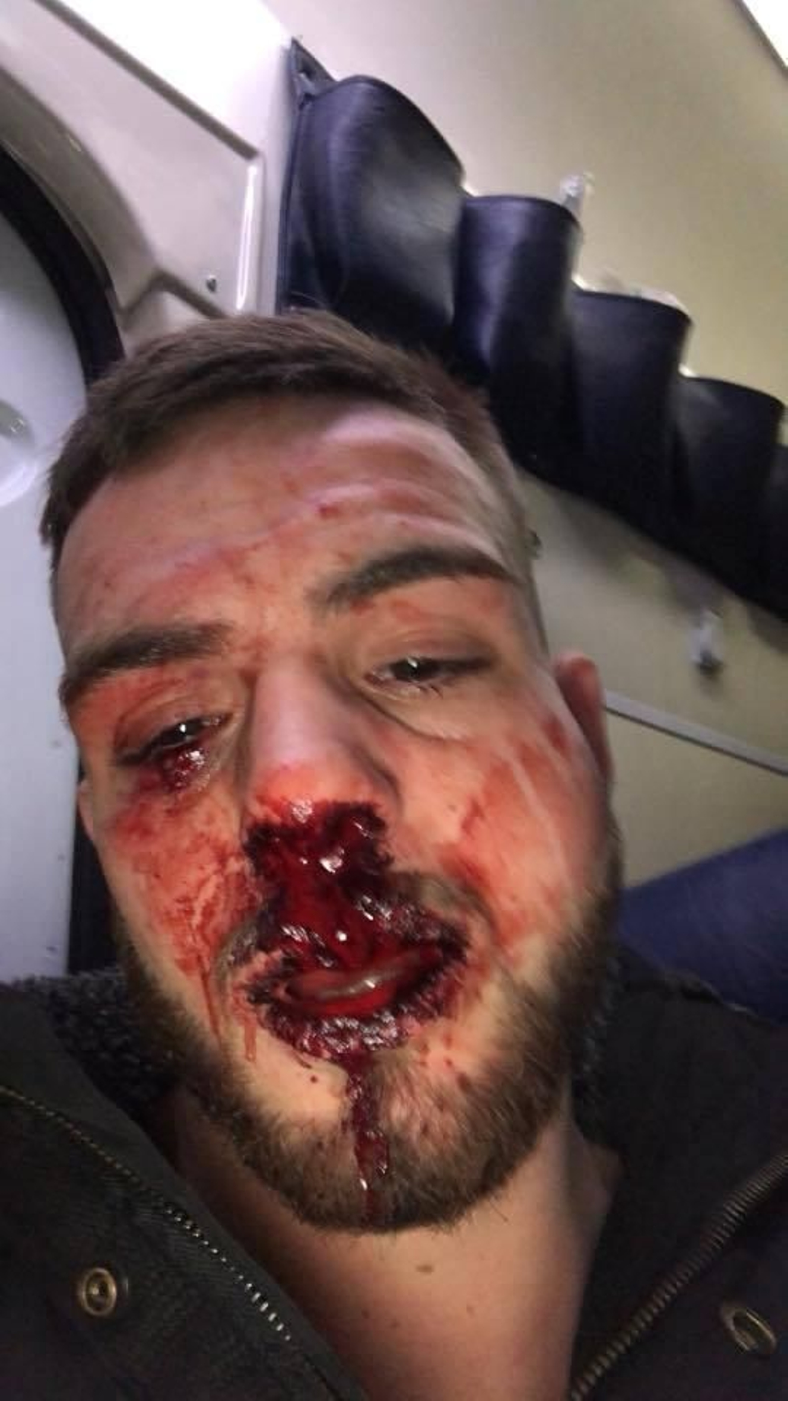 El joven tras la brutal agresión.