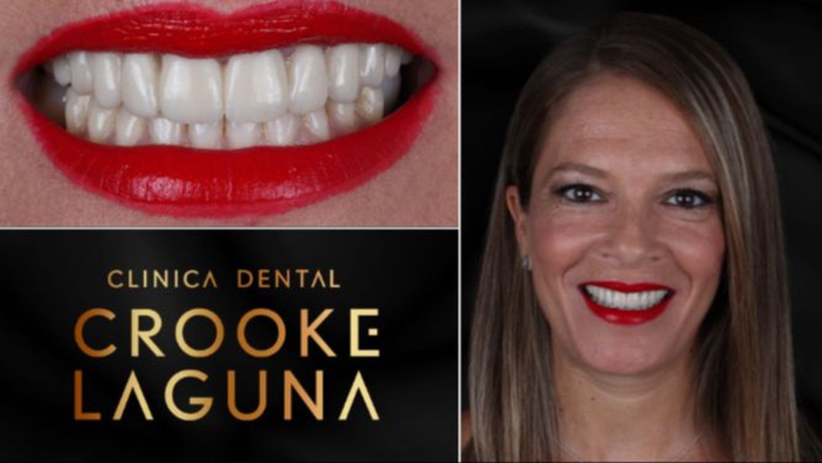 Una nueva sonrisa, una nueva vida