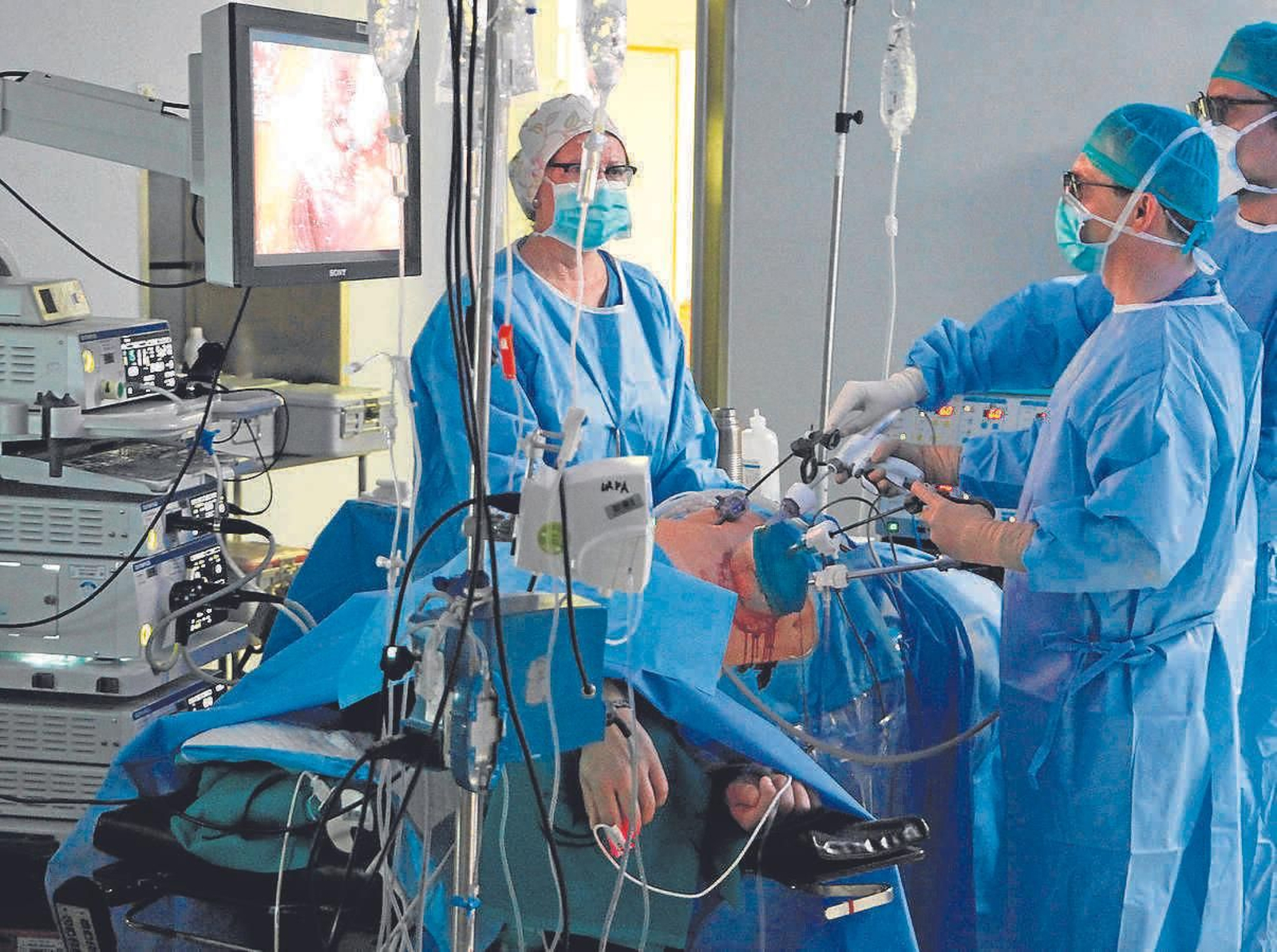 Los trasplantes que más se realizan en Sevilla son los renales