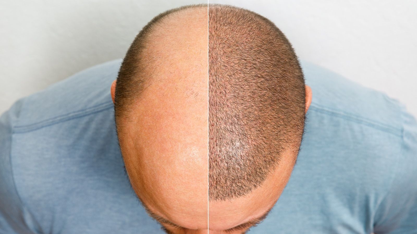 ¿Por qué sentimos miedo antes de un cambio de imagen?