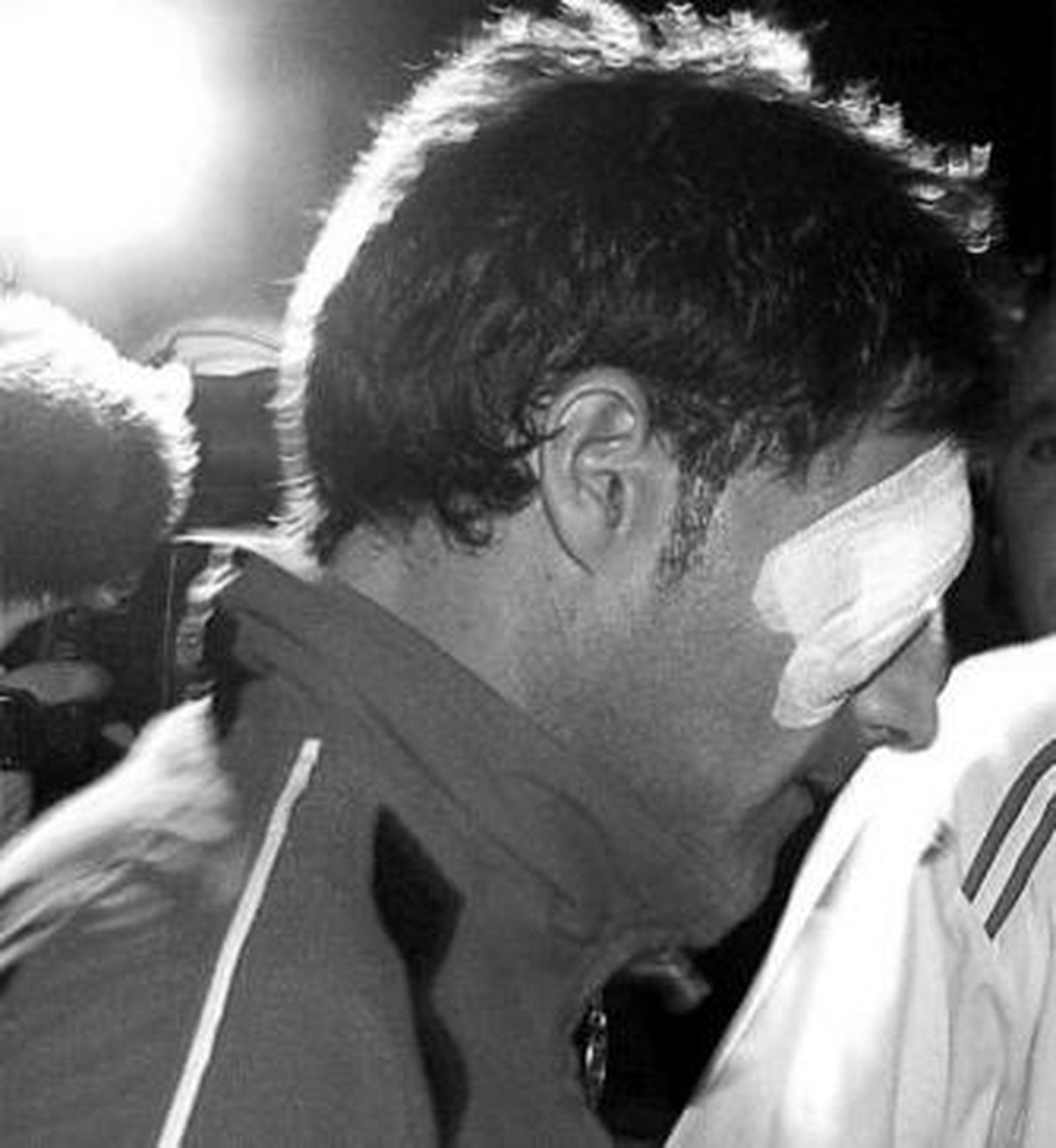 Armando abandona el estadio con su ojo derecho vendado.