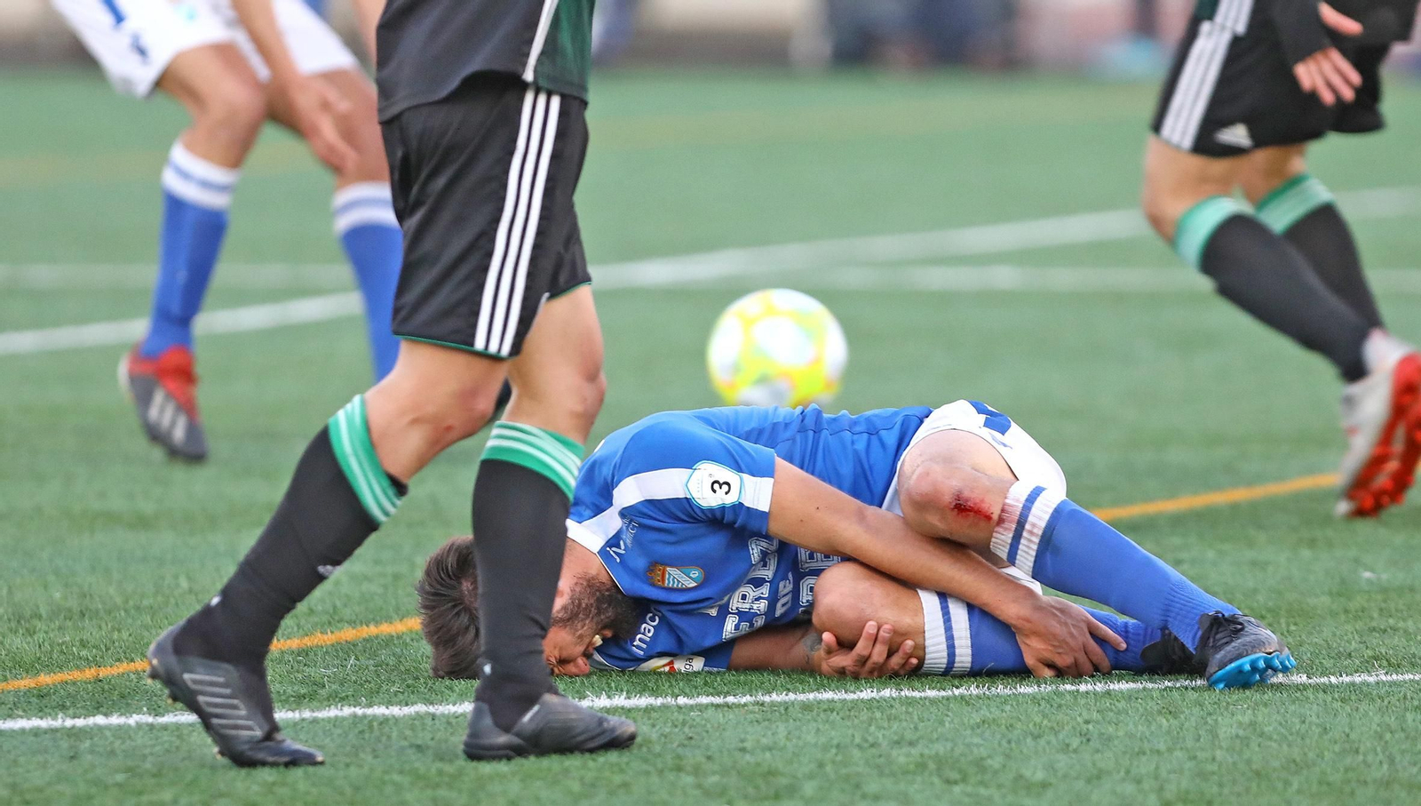 Imágenes del Xerez CD - Córdoba B (2-3)