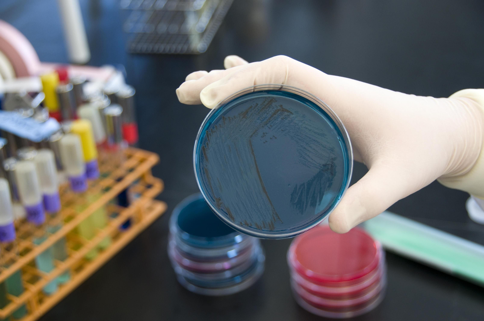 Un microbiólogo examina muestras para detectar la presencia de salmonela. Un microbiólogo examina muestras para detectar la presencia de salmonela.
